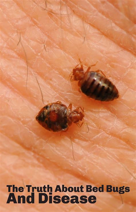 Bed Bug Bite Pest Control