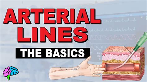 What Is An A Line Arterial Line Basics Explained Youtube