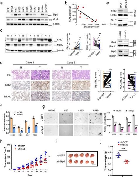 Skp2 Mediated Mlkl Degradation Confers Cisplatin Resistant In Non Small