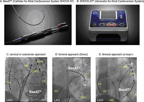 07316783 H4 Utility And Safety Of A New Internal Cardioversion System During Catheter Ablation