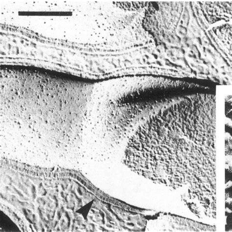 A Electron Micrograph Of A Platinum Shadowed Freeze Fracture Replica