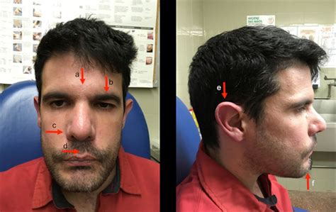 Parkinsons Disease With Hypocalcaemia Adult Presentation Of Q