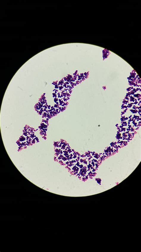 Micrococcus Luteus Gram Stain