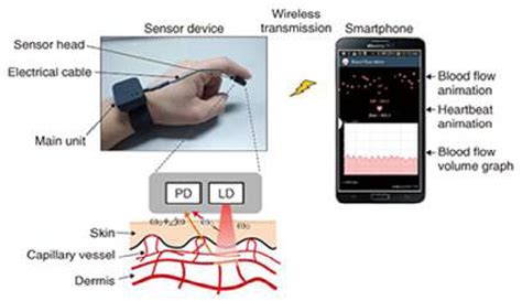 Dynamics of laser doppler flowmetry development from prototype to... | Download Scientific Diagram