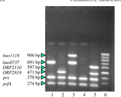 Table 1 From Evaluation Of A Multiplex PCR Assay As An Alternative