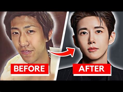 Korean Actors Before And After Plastic Surgery - Infoupdate.org