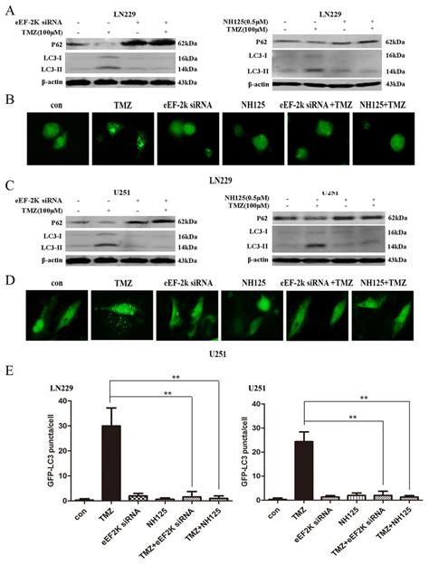 Effect Of Inhibiting EEF 2 Kinase On The TMZ Induced Autophagy