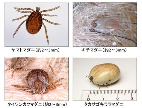 全文表示 マダニによる感染症が増加中 咬まれない工夫の仕方 J CASTニュース