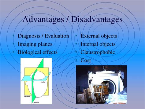 Ppt Magnetic Resonance Imaging Powerpoint Presentation Free Download