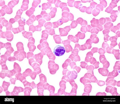 Human blood smear with lymphocyte, light micrograph Stock Photo - Alamy