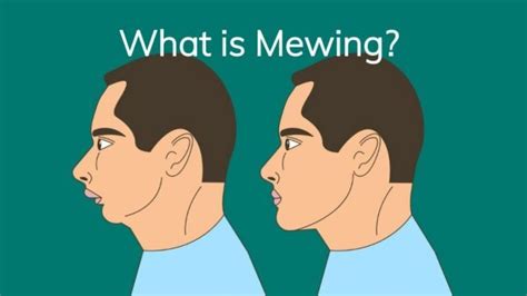 Mewing Là Gì Cách Tập Mewing Chi Tiết Và Lưu ý Khi Tập