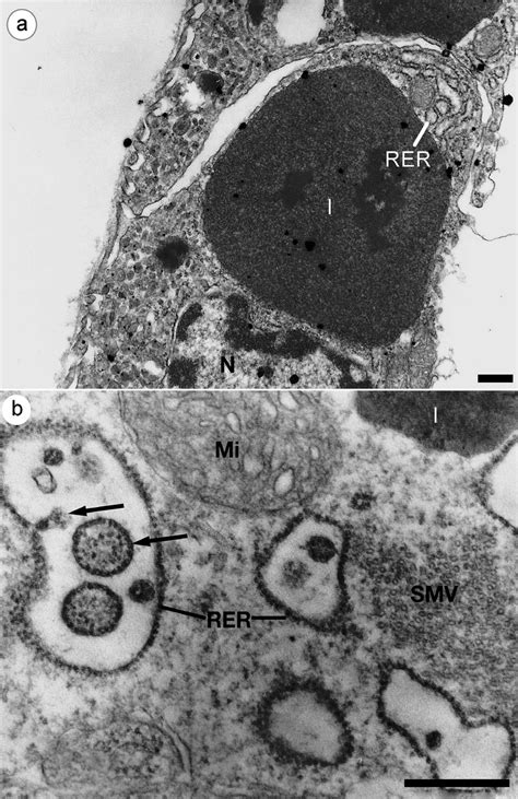 Litopenaeus Vannamei Ultrastructural Changes In Cells At The Midstages