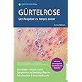 G Rtelrose Der Gro E Ratgeber Zu Herpes Zoster Schulmedizin