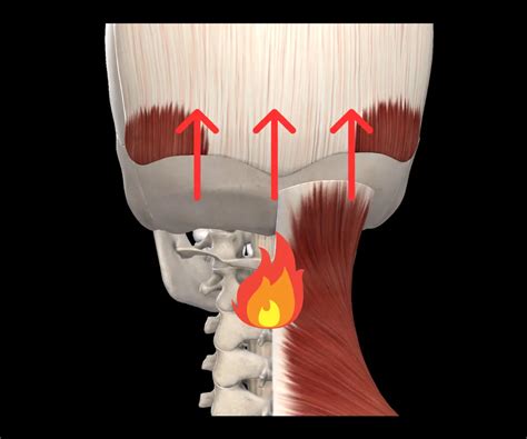 Confusione Mentale Sintomo Di Prime Vertebre Cervicali Infiammate