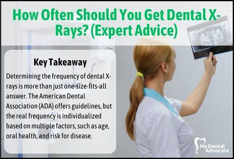 How Often Should You Get Dental X Rays Expert Advice