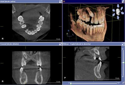 Tac Dental D Orientado Hacia Un Mejor Diagn Stico Abaden Dentistas