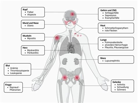 Clinical Findings Exhibit Extensive Variability