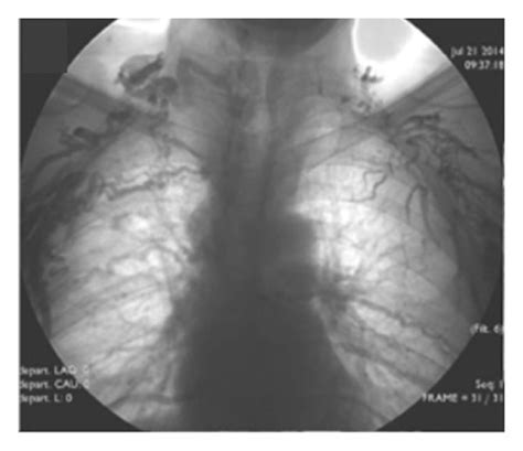 A 30-year-old male who presented with a history symptoms and signs of ...