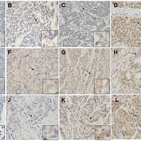 Immunohistochemical Staining Of DNMT3a DNMT3b And DNMT1 Proteins In