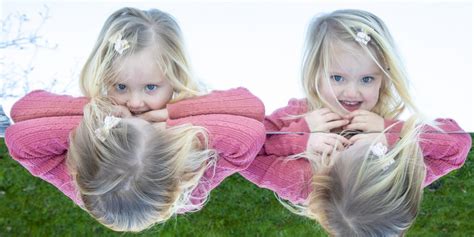 Meet The Asymmetrical ‘mirror Image Twins Who Do Everything From Parting Their Hair To Holding