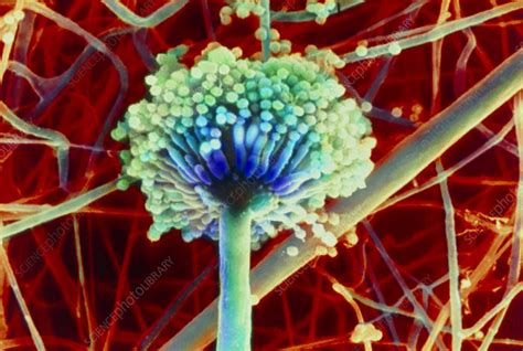 Aspergillus Niger Fungus Stock Image B250 0677 Science Photo Library