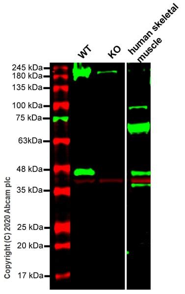 Anti Beta Dystroglycan Antibody Ab43125 Abcam