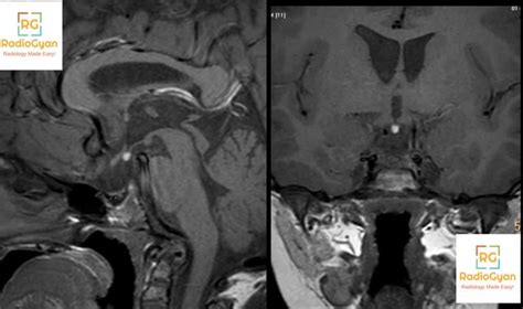 Radiology Spotters Set Radiogyan Radiogyan