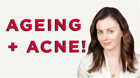 How To Treat Acne And Ageing At The Same Time Dr Sam Bunting Youtube