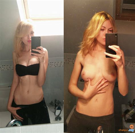 Before After Vol A Amt Porn Pic