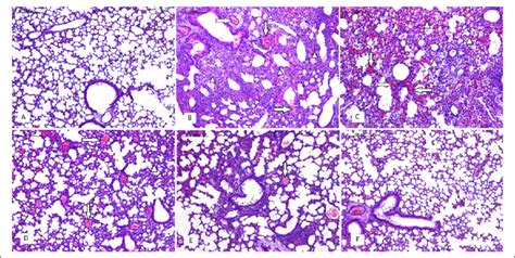 Effects Of Salidroside SDS Treatment On Histopathological Changes In