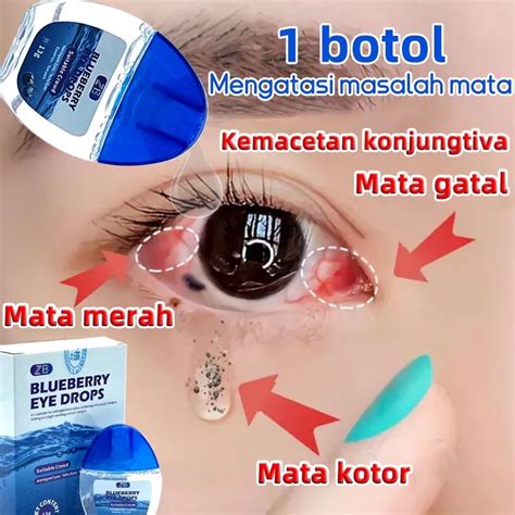 Jual Obat Mata Minus Tetes Mata Minus Katarak Silinder Obat Mata