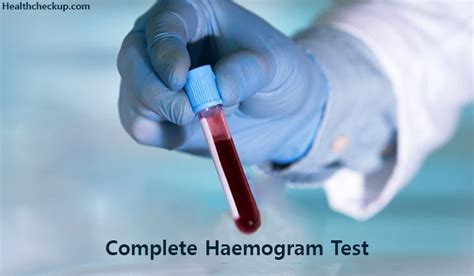 Complete Blood Count CBC Test Preparation Procedure And Normal Ranges