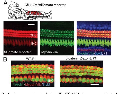 Hair Cell Differentiation Semantic Scholar