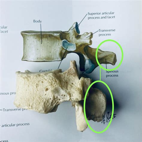 Superior Articular Process