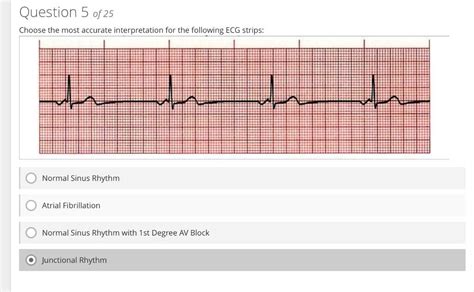 Solved Need Help With These Ecg Rhythm Interpretations Pl