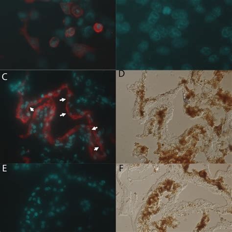 Localization Of HBest2 In Transfected HEK 293 Cells And Human Ciliary