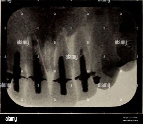 Dental And Oral Radiography A Text Book For Students And