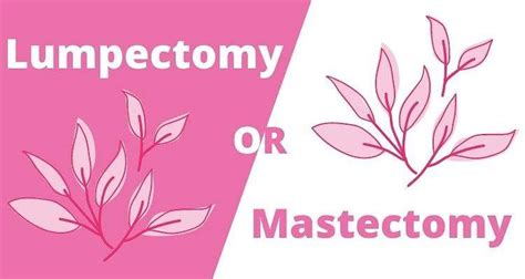 Lumpectomy or Mastectomy: How to Choose - Josie's Journey