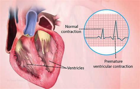 Health Condition Symptoms Causes Treatment And More