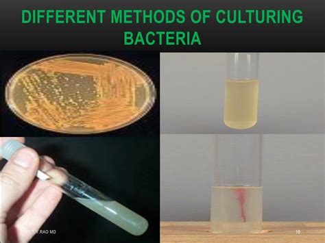 Ppt Bacterial Culture Methods Basics Powerpoint Presentation Free Download Id2157627