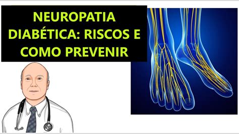 Neuropatia diabética fatores de risco complicações como prevenir e