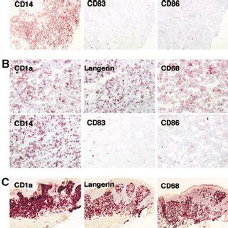 Cd A Langerin Cells May Express Cd But Not Dc Lamp In