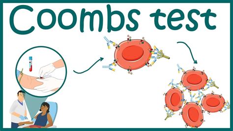 Coombs Test Principle Types Procedure And Result Off