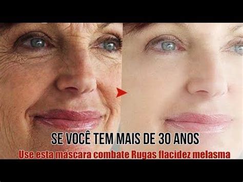 Se Voc Tem Mais De Anos Use Por Noites Combate Rugas E Manchas