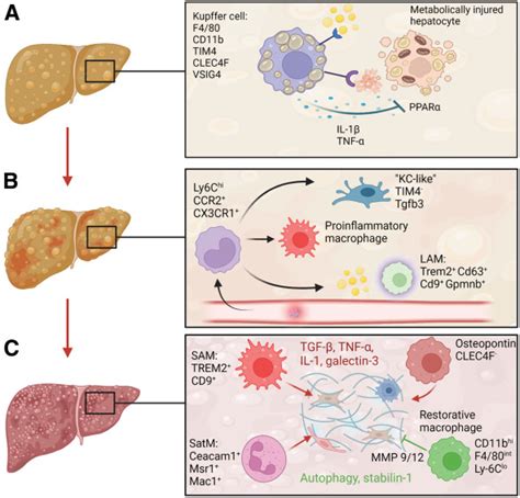 The Multifaceted Roles Of Macrophages In Nafld Pathogenesis Cellular