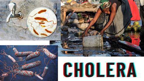 Vibrio Cholera Causes Symptoms Prevention Diagnosis Youtube