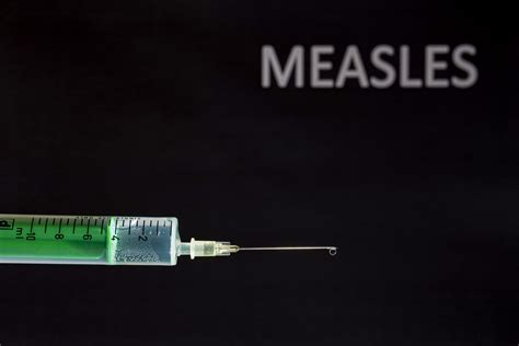 Global Measles Deaths Are Surging Who Finds Here’s Why