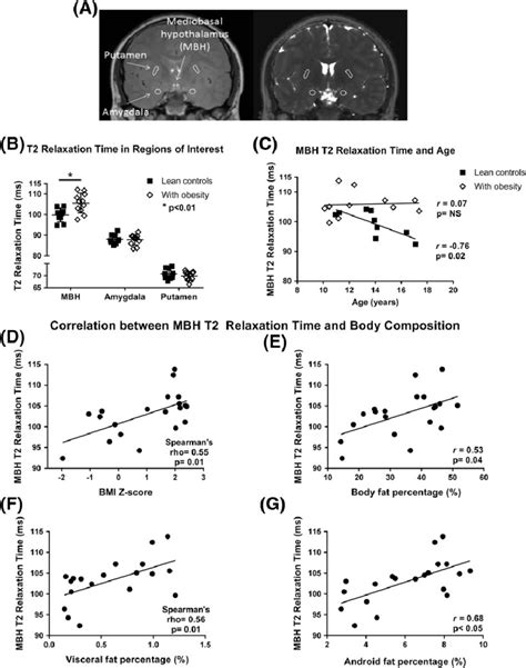 Measurement Of T2 Relaxation Time And Its Relationship To Obesity And Download Scientific