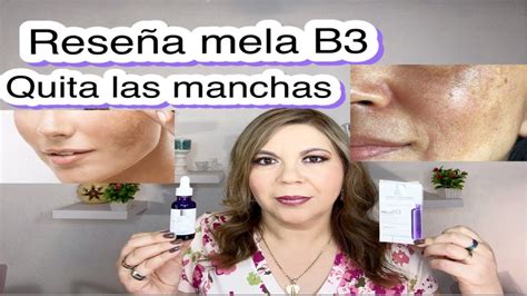 Rese A Mela B Roche Posay Serum Funciona Quita Las Manchas Youtube