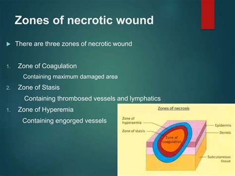 Protocols Of Wound Debridement Ppt